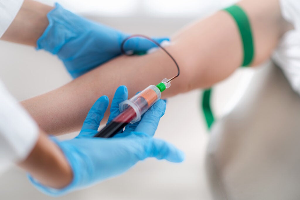 Gloved hands hold a syringe while drawing blood from a patient