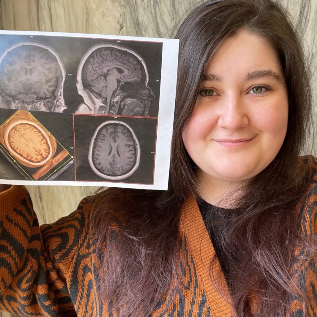 Integrative Neuroscience student Anne Schauer poses with an MRI image of her brain she received through the master's program. Photo courtesy of Anne Schauer